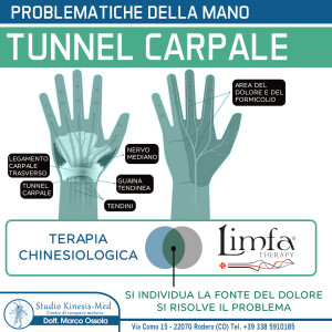 tunnel carpale